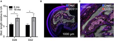 Age-Dependent Changes in Bone Architecture, Patterning, and Biomechanics During Skeletal Regeneration